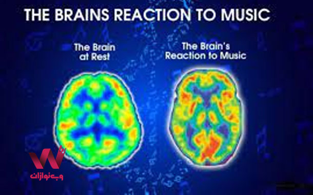 تاثیر موسیقی موتسارت بر مغز